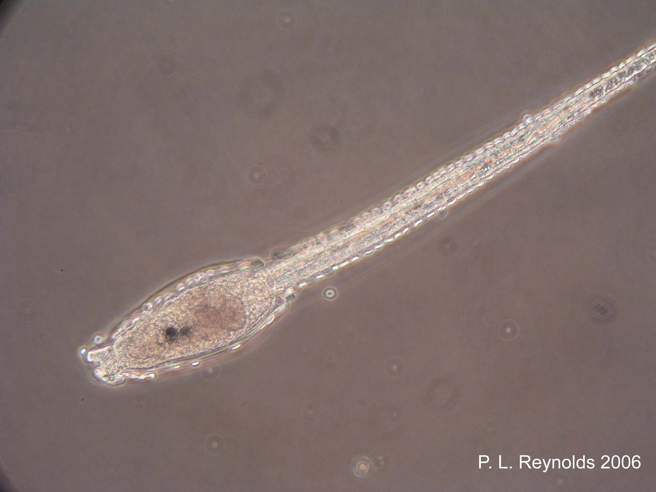 Шаровидная асцидия. Кровеносная система асцидии. Личинка асцидии. Личинка асцидии. Оболочники строение личинки.