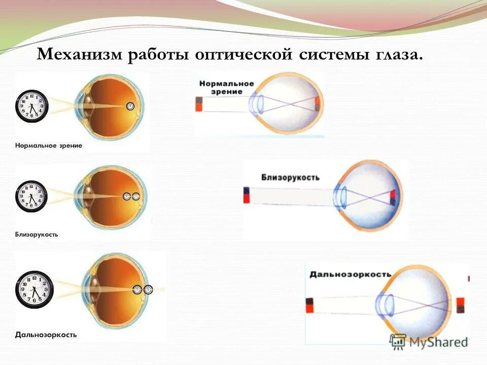 Механизм работы оптической системы глаза. Схема оптической системы глаза. Оптическая схема глаза человека. Упрощенная оптическая схема глаза.