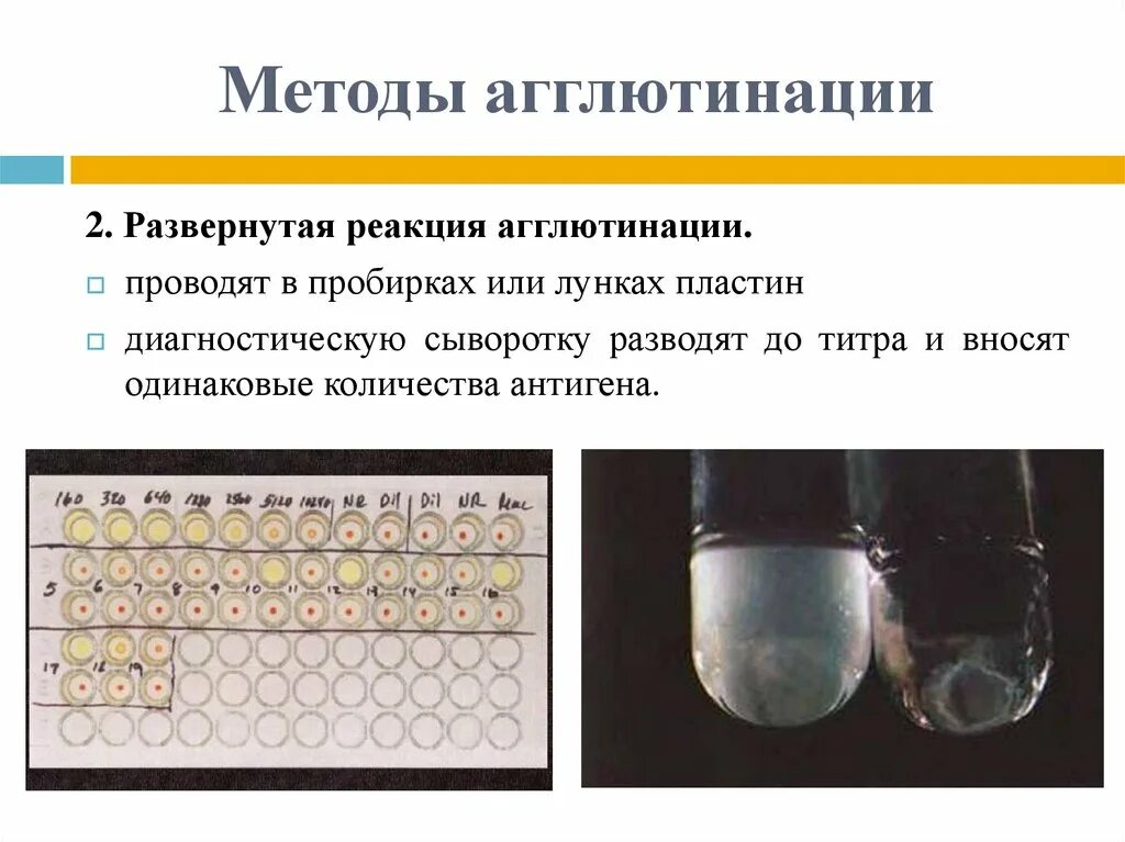 В пробирке произошла агглютинация это означает. Методы агглютинации. реакция агглютинации. реакция агглютинации и ее варианты. развернутая агглютинация.