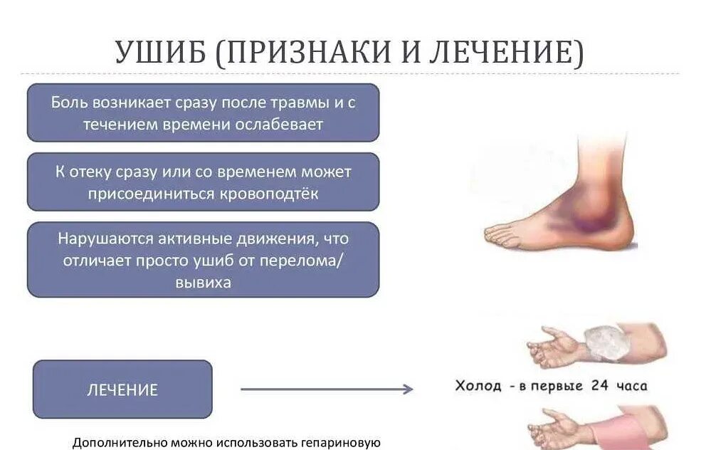 Как узнать ушиб. Клинические признаки растяжения ушибов переломов. кушибо.