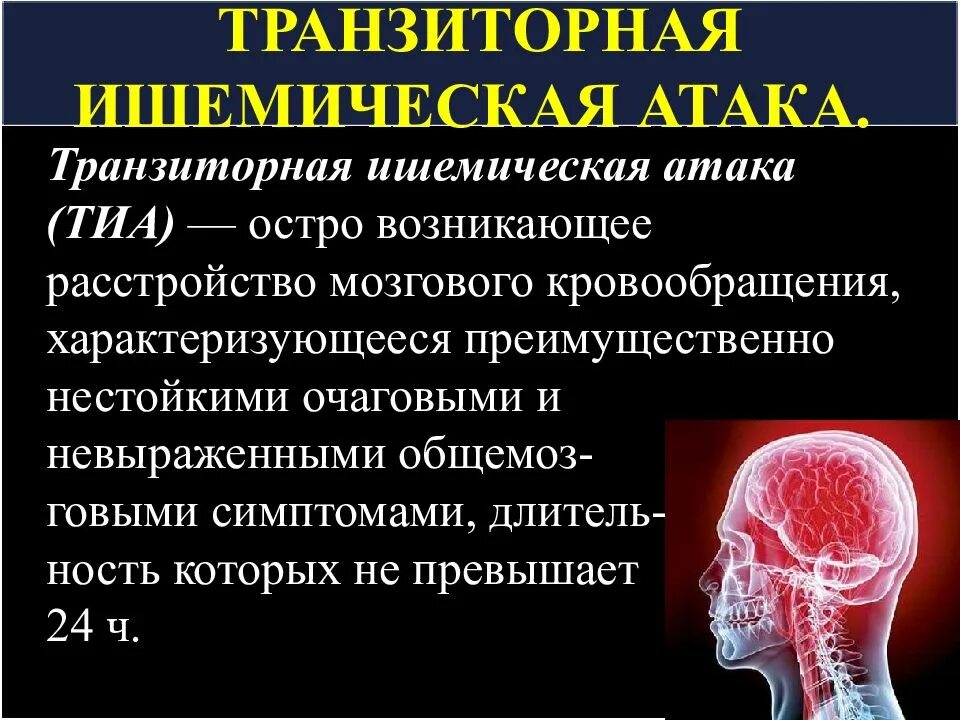 Тиа и инсульт отличия. Транзиторная ишемическая атака (тиа). Транзиторные ишемические атаки. Транзиторная ишемическая атака диагноз. Транщиторна игесическая виака.
