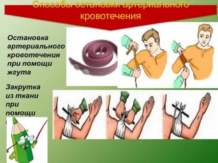 Альтернативный способ остановки артериального