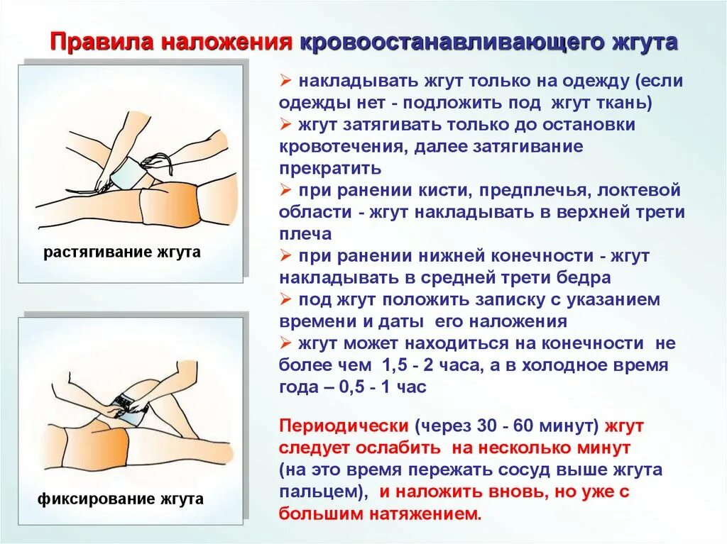 Максимальное время повторного наложения. Техника наложения кровоостанавливающего жгута жгута. Наложение восстанавливающего жгута. Правило наложения кровоостанавливающего жгута. Правила наложения кровоостанавливающего.