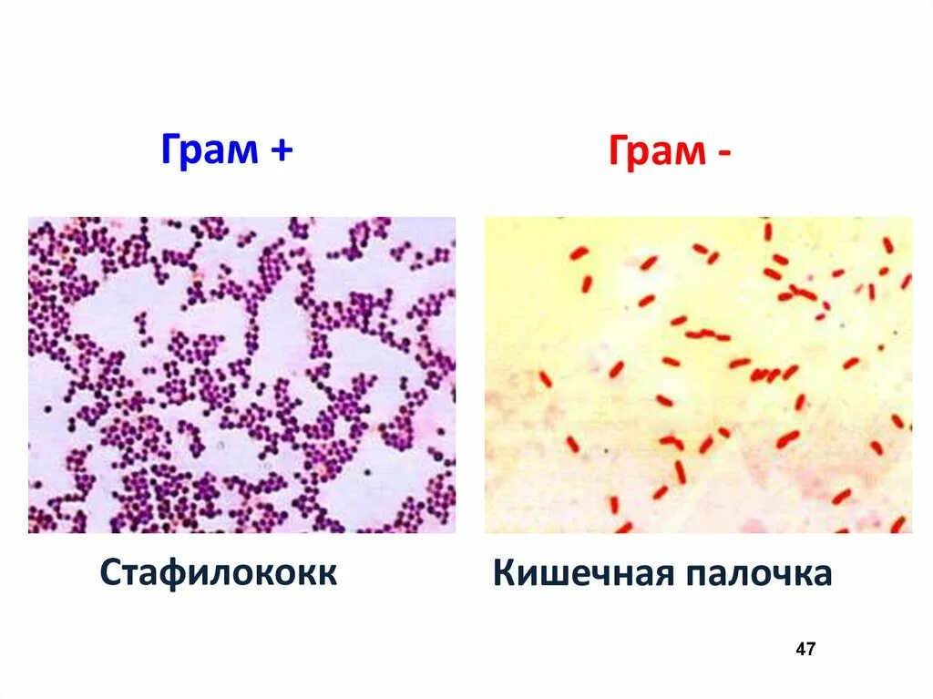 Грамм отрицательные палочки