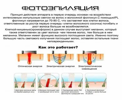 Лазерная эпиляция интервал