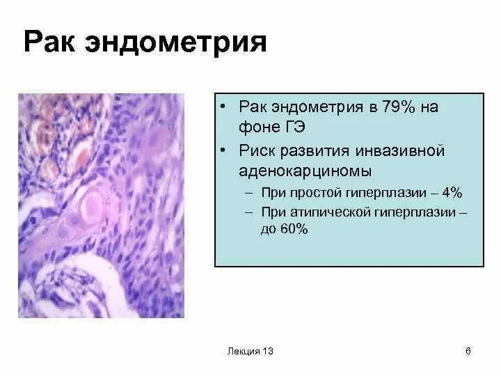 Гиперплазия при климаксе. Атипическая гиперплазия эндометрия терапия. Атипическая гиперплазия эндометрия УЗИ. Атипическая гиперплазия эндометрия морфологически наиболее сходна:. Высокодифференцированная аденокарцинома эндометрия.