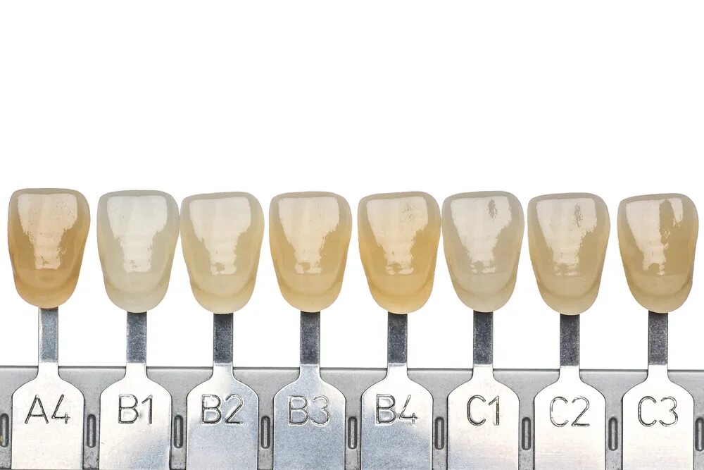 Металлокерамика зубы цвета. Белоснежный цвет зубов. Цветной зубной имплант. Цвет имплантов. Металлокерамика коронки цвет а2.