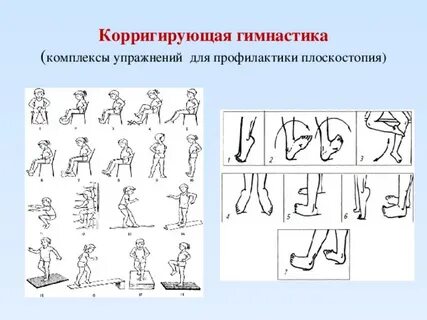 Упражнения для профилактики нарушения плоскостопия