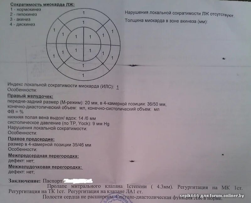 Индекс локальной сократимости миокарда. Индекс локальной сократимости миокарда норма. Нормокинез. Сократимость миокарда нормокинез.