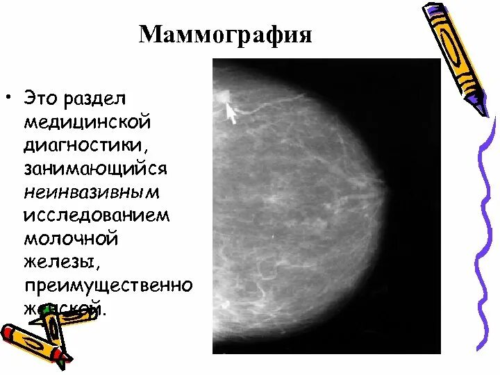 Маммография ответы