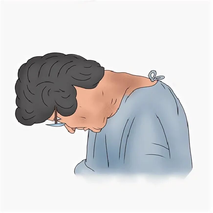 Head drop