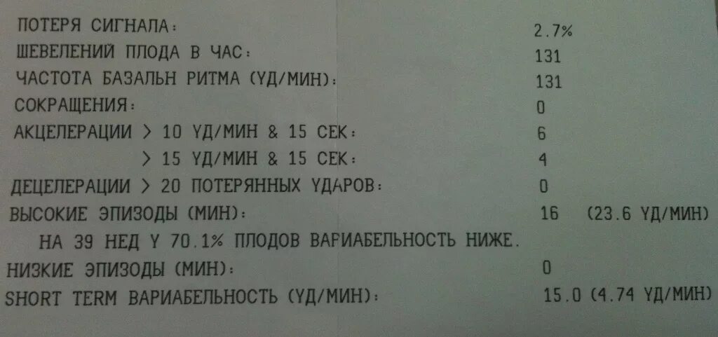 Беременность 39 недель как ускорить. КТГ плода норма 38 неделе беременности. Норма КТГ В 39 недель беременности. КТГ на 39 неделе беременности. КТГ 39 недель норма.