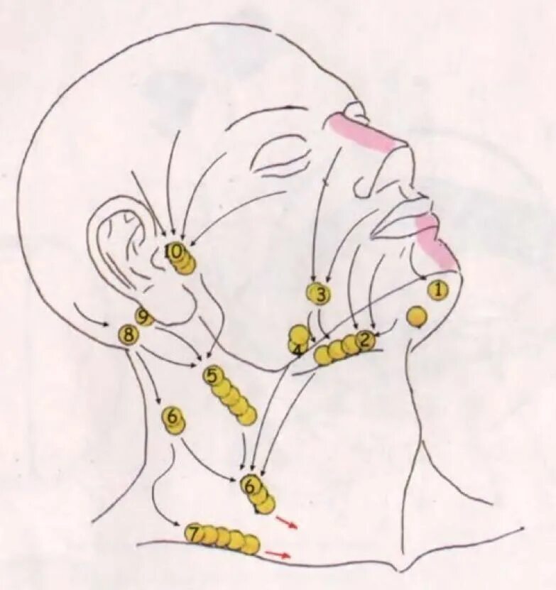 Схема лимфоузлов головы. Лимфоотток шейные лимфоузлы. Поднижнечелюстные лимфоузлы расположение. Шейные лимфоузлы расположение схема. Околоушные лимфатические узлы схема.