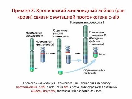 Острый лейкоз мутация