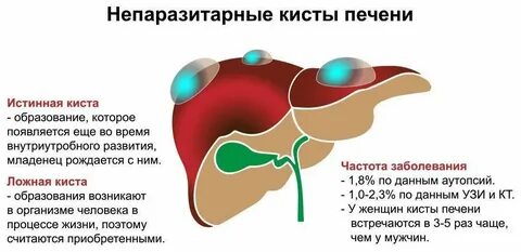 Образование s8 печени