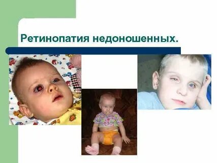 Ретинопатия у ребенка
