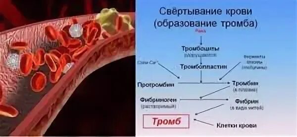 Тромб егэ