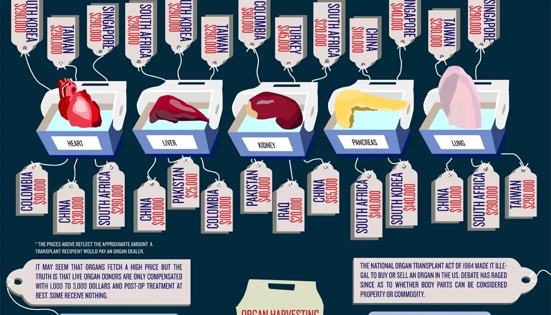 Мужской донор. Черный рынок человеческих органов. Цена человеческих органов. Стоимость органов.