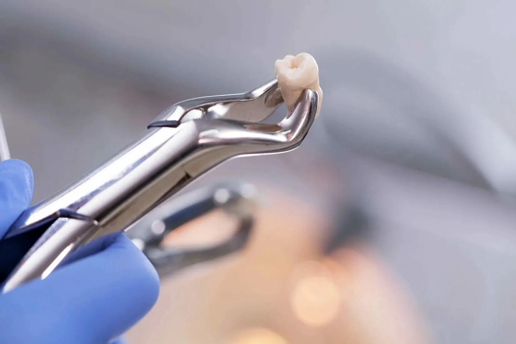 Удаление зуба. Хирургическая стоматология.