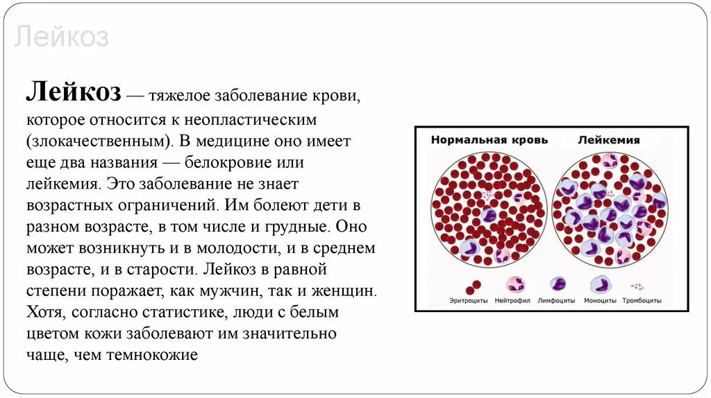 Злокачественные заболевания крови. Злокачественный лейкоз