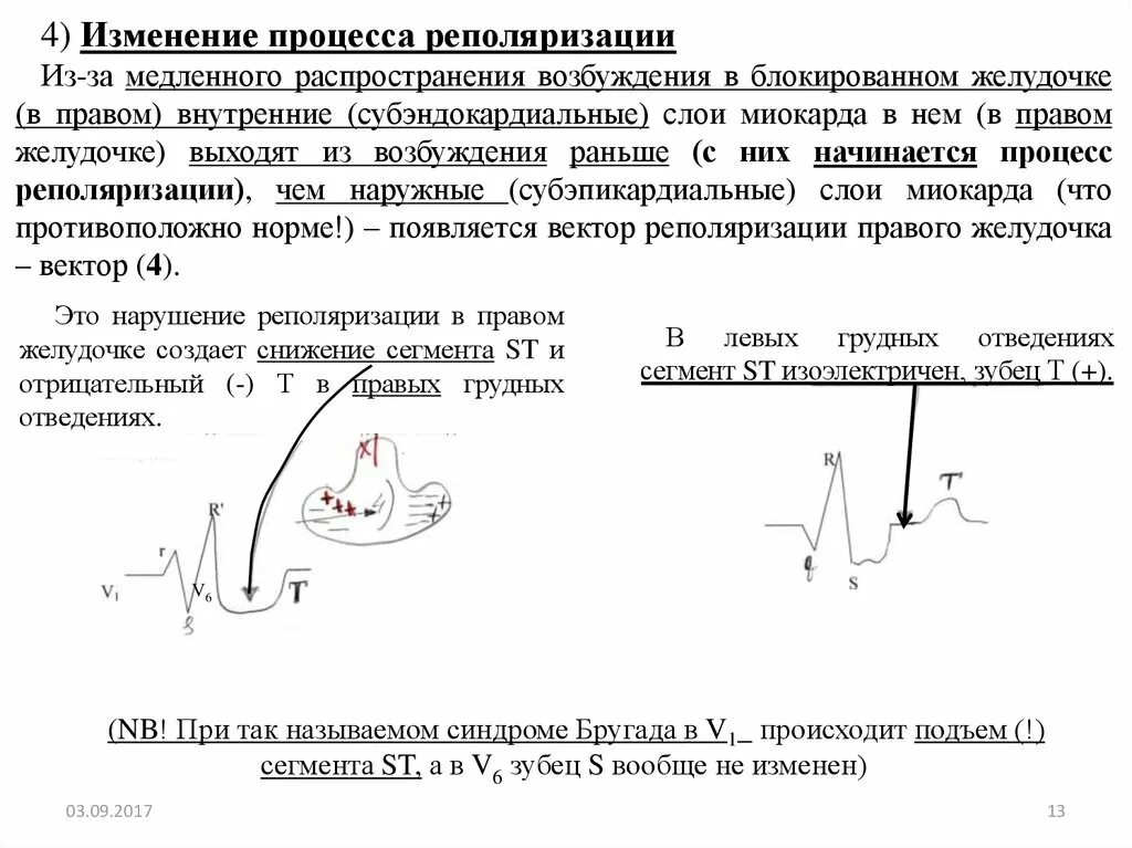 Нарушение процесса реполяризации желудочков в нижней стенке. Реполяризация миокарда желудочков ЭКГ. Нарушение процессов реполяризации в миокарде. Неспецифические процессы реполяризации на ЭКГ. Неспецифические нарушения процессов реполяризации.