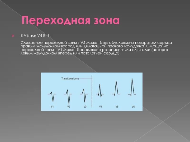 Поворот правым желудочком вперед