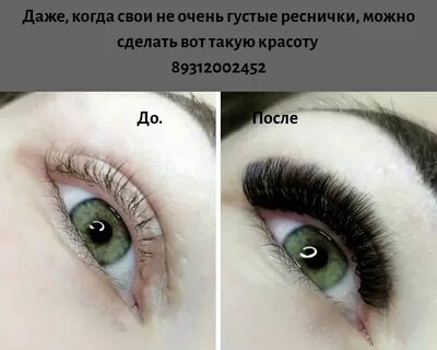 Перемещается с помощью ресничек