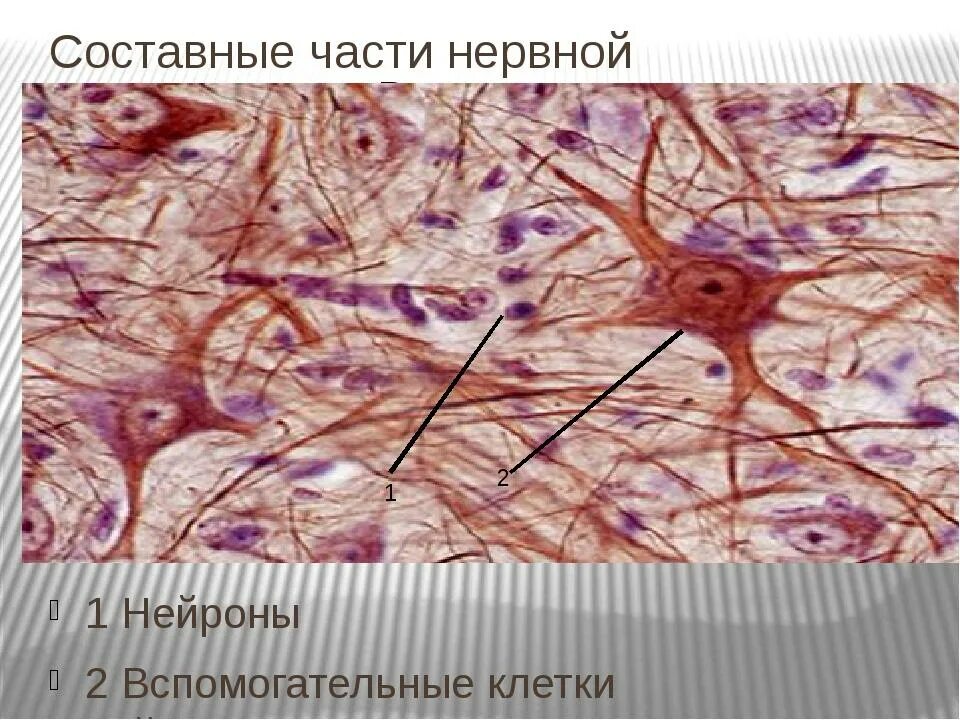 Клетки нейроглии гистология. Нейроглия гистология препарат. Нейроглия клетки гистология препарат. Строение нервной клетки гистология.