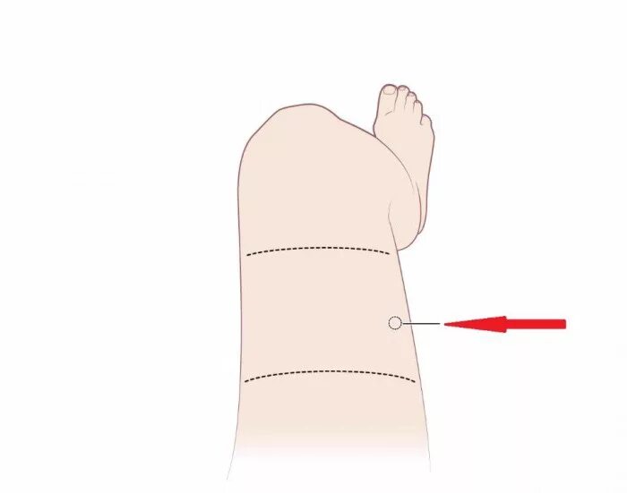Как поставить укол в бедро внутримышечно самому. Как правильно ставить уколы внутримышечно в бедро самому себе. Укол в бедро внутримышечно схема. Укол в бедро внутримышечно. Техника введения внутримышечной инъекции в ногу.