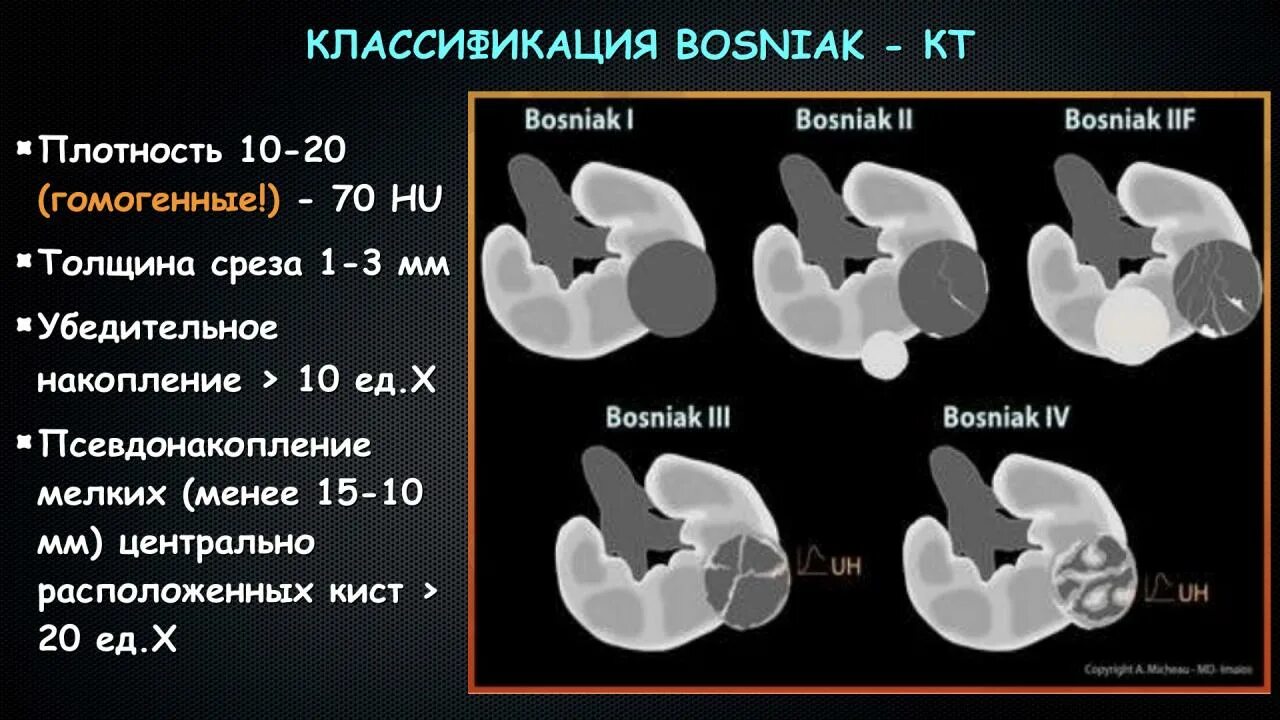 Bosniak классификация кт. Bosniak классификация кт