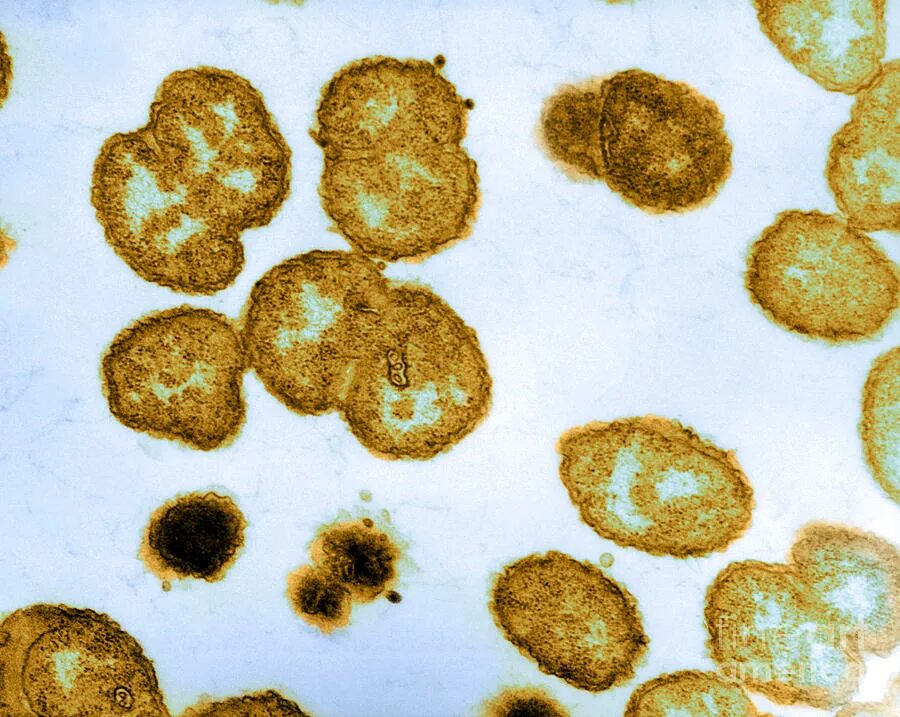 Chlamydia trachomatis neisseria gonorrhoeae. Гонококки, гонорея под микроскопом.