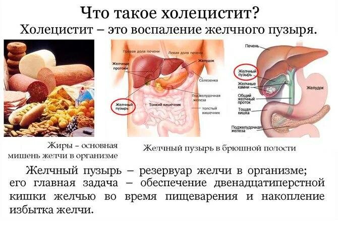 Болит желчный пузырь причины. Проблемы с желчным пузырем симптомы. Болезни печени и желчного пузыря. При воспалении желчного. Проблемы с желчным симптомы.