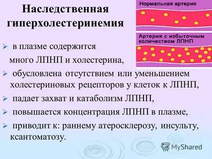 Гиперлипидемия что это такое у человека