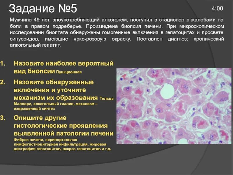 Как лечить жировую инфильтрацию
