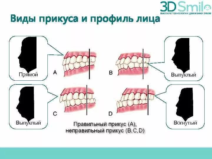 Зубы при закрытом рте. Правильный прикус у человека схема сбоку. Правильный прикус вид сбоку у ребенка. Правильный прикус зубов сбоку. Правильное расположение зубов сбоку.