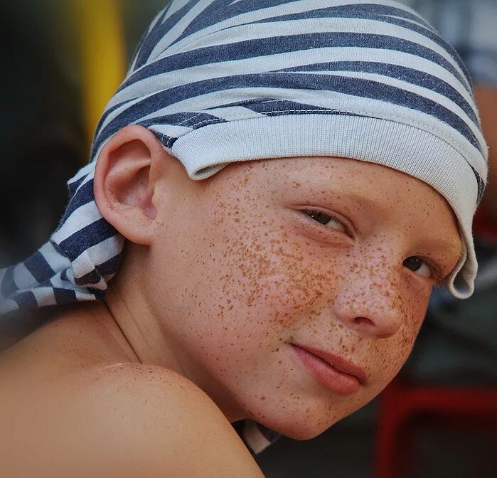 веснушки у детей. рыжий мальчик. николь уивер с веснушками. рыжий мальчик. рыжие дети с веснушками.