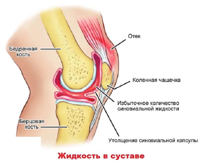 Как выглядит коленка