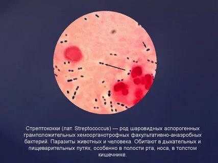 Стрептококк во рту