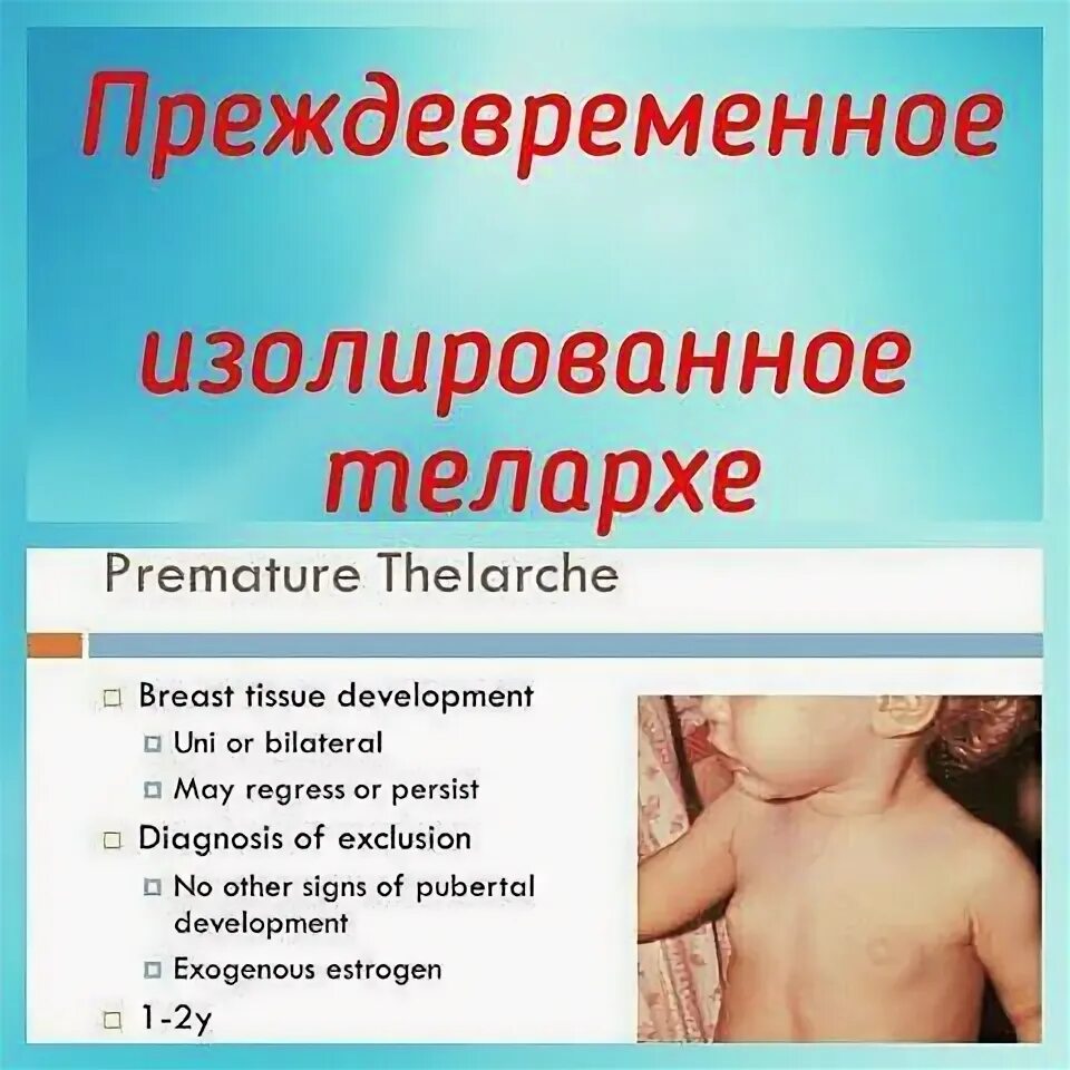 Телархе это. Ппр синдром изолированного телархе. преждевременное изолированное телархе. синдром преждевременного телархе. синдром преждевременного полового развития.