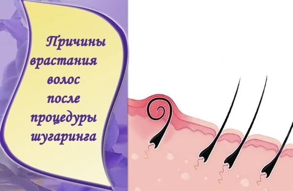 Шугаринг через сколько растут волосы. Шугаринг через сколько растут волосы