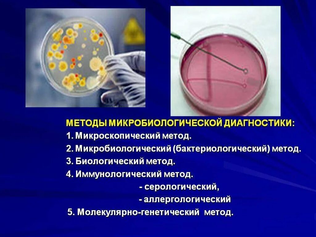 Методы микробиологической диагностики протозойных инфекций. Микроскопический метод диагностики микробиология. Методы микробиологического исследования серологический. Методы исследования серологический бактериологический. 2 этап бактериологического метода