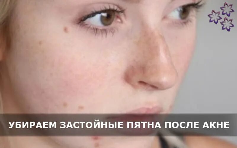 Как убрать пятно после