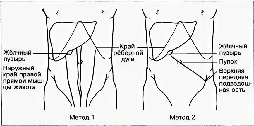 Проекция желчного пузыря на переднюю брюшную стенку. Точка проекции желчного пузыря. точка проекции желчного пузыря на переднюю брюшную стенку. точка проекции дна желчного пузыря.