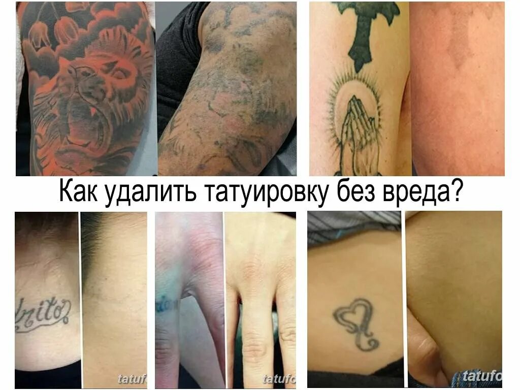 Является ли тату. Сведение тату до и после.