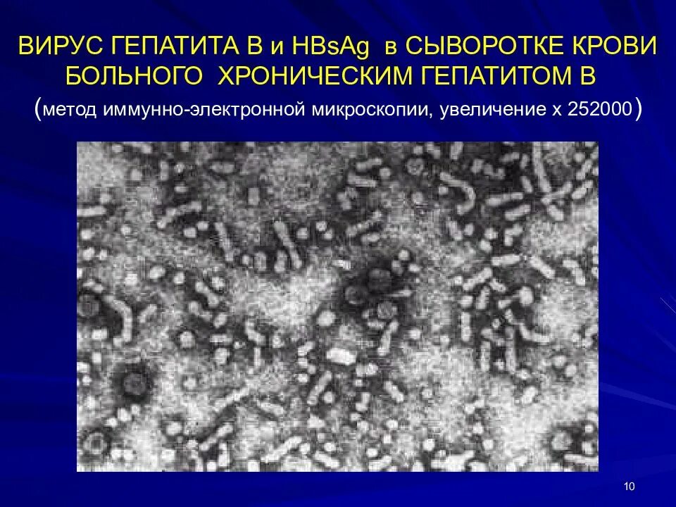 Гепатит а микробиология. Иммуноэлектронная микроскопия микробиология. иммунная электронная микроскопия. гепатит а электронная микроскопия. вирус гепатита с электронная микроскопия.