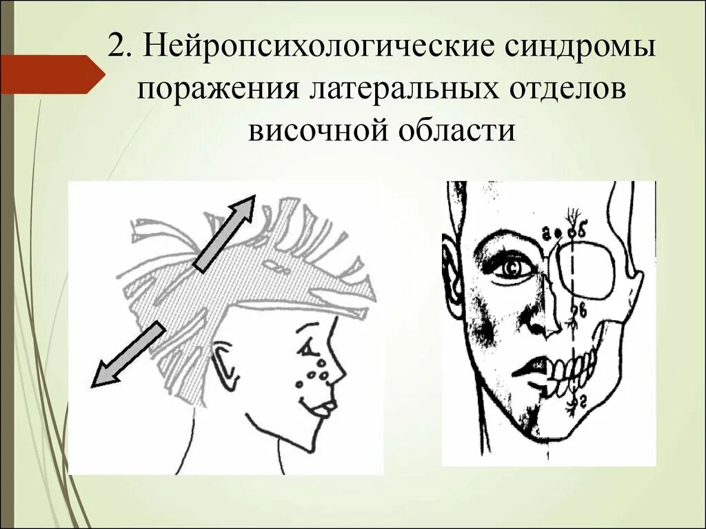 Нейропсихологические синдромы. Латеральные отделы височной области. Нейропсихологический синдром (синдромы. Синдром поражения височной области. Нейропсихологические синдромы поражения мозга