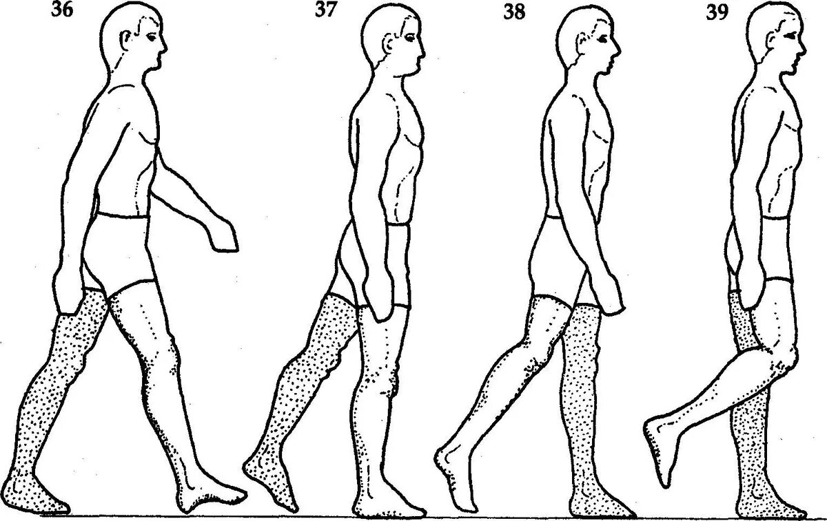 Расстройство походки. Походка больного. Движение ног при ходьбе. Нарушение ходьбы. Движение конечностей 3
