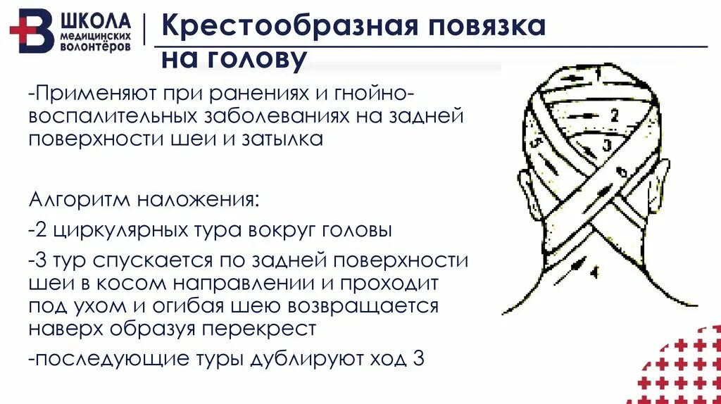 Крестообразная повязка на затылок алгоритм. Наложение «восьмиобразной» повязки на затылок и шею. Наложение крестообразной повязки на затылок алгоритм. Крестообразная повязка техника наложения.