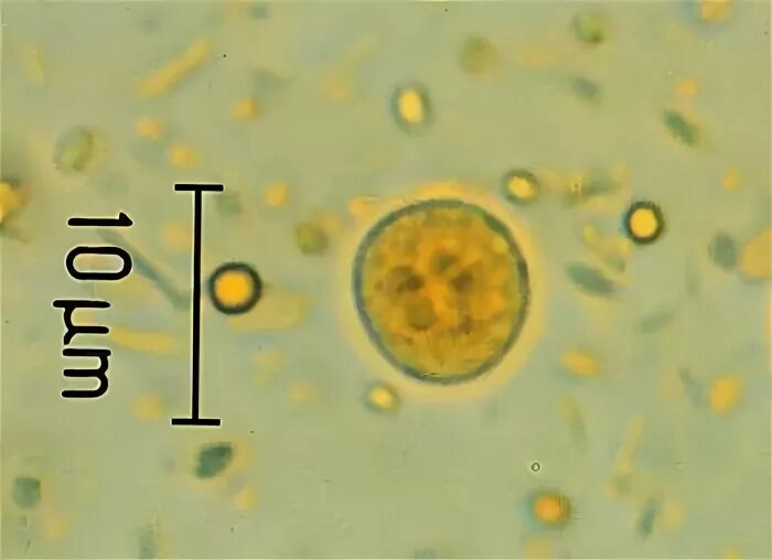 Цисты в воде. Endolimax nana микроскопия. цисты лямблии микроскопия.