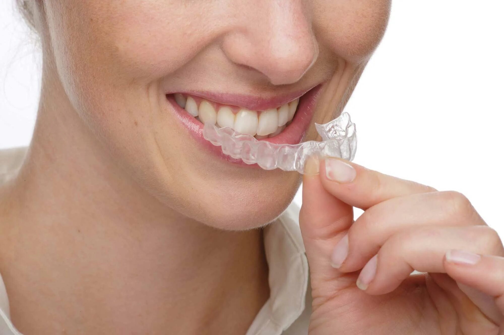 Каппы Инвизилайн Invisalign. Элайнеры Invisalign. Элайнеры Стар Смайл на зубах. Сильная чувствительность зубов